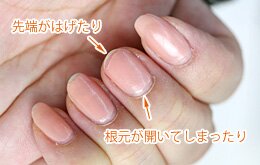 マニキュアにトラブルが