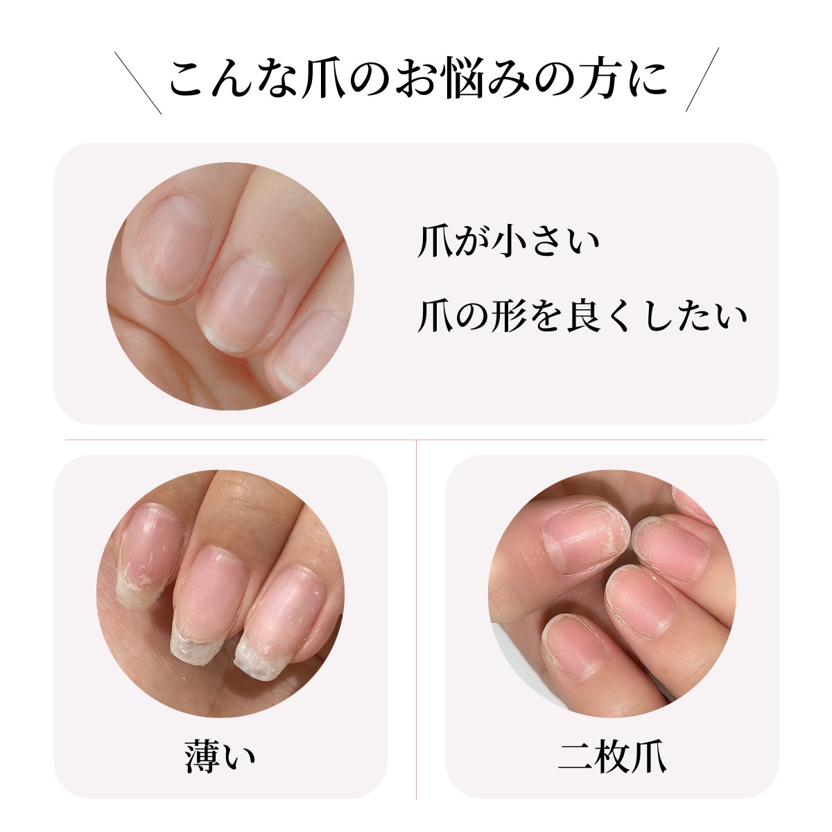 LCN アンティセプト内容量16ml