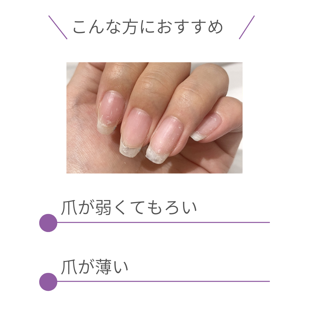 LCN DP トップアンド ベースコート 8ml ダイヤモンドパワー トップコート 強く 美しく 保護 光沢