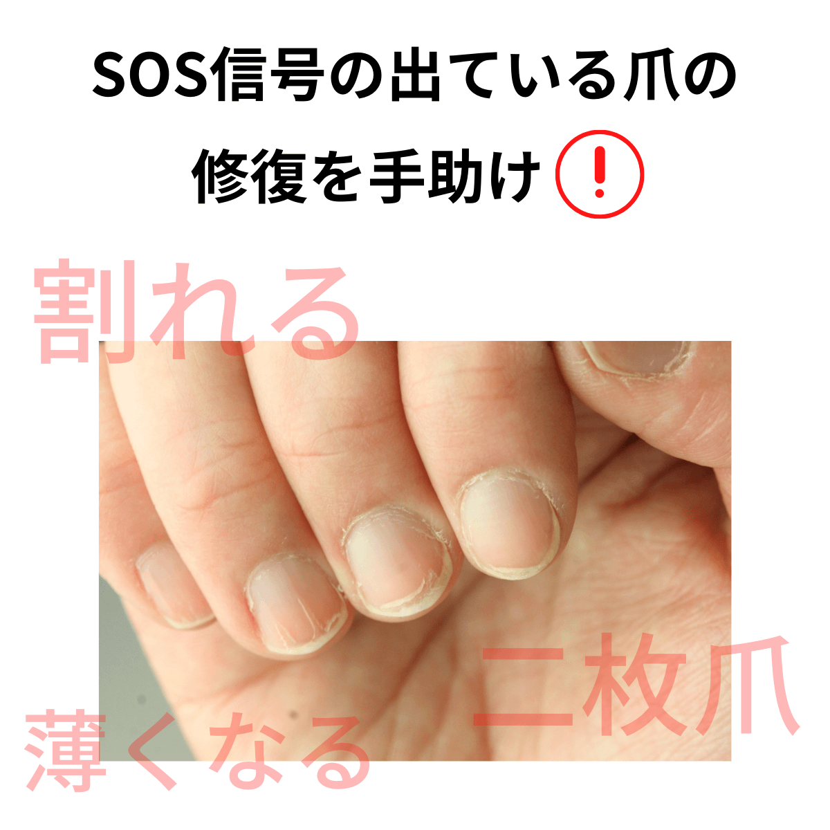 国内正規品 Opi オーピーアイ ネイルエンビー オリジナル 15ml 爪強化剤 爪割れ 薄い爪 二枚爪 ネイルケア ベースコート Opi