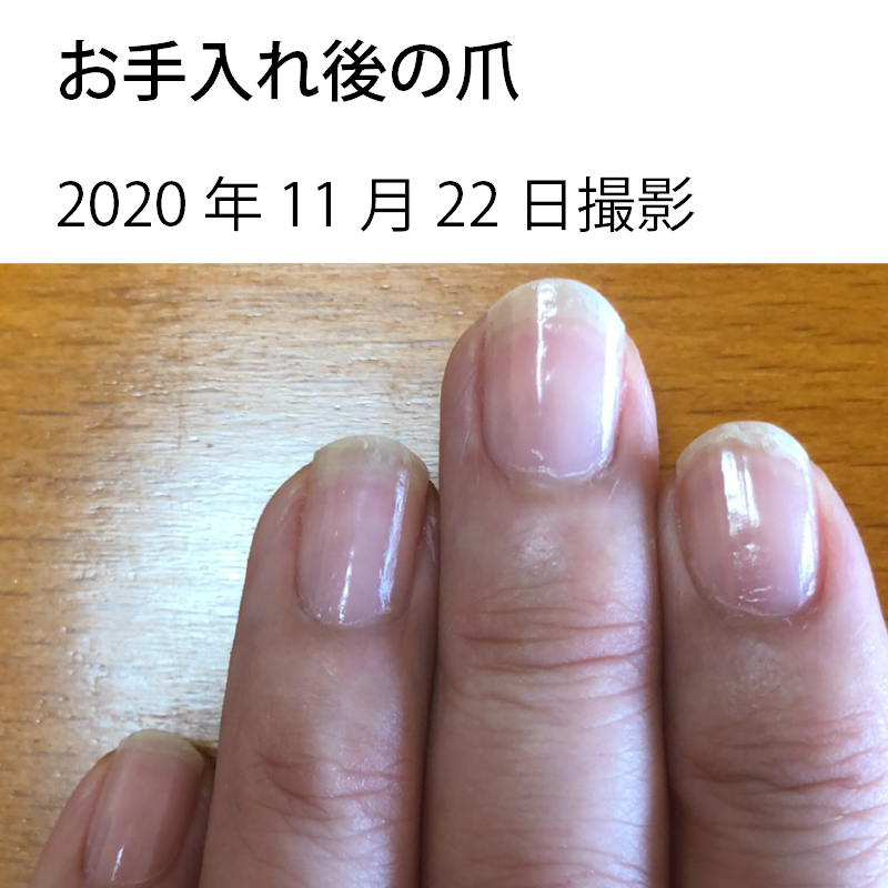 国内正規品 Opi オーピーアイ ネイルエンビー オリジナル 15ml 爪強化剤 爪割れ 薄い爪 二枚爪 ネイルケア ベースコート Opi 国内正規品 Opi オーピーアイ ネイルエンビー オリジナル 15ml 爪強化剤 爪割れ 薄い爪 二枚爪 ネイルケア ベースコート Opi