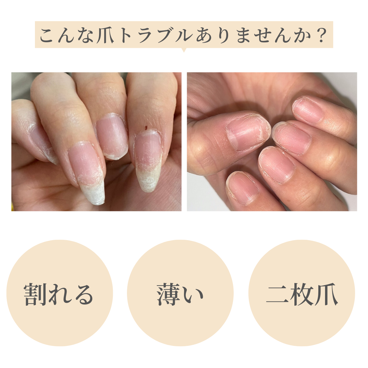 国内正規品 OPI オーピーアイ ネイルエンビー NL 223 Pink to Envy ピンク トゥ エンビー 15ml カラー 爪強化剤 爪割れ  薄い爪 二枚爪 ネイルケア ベースコート opi