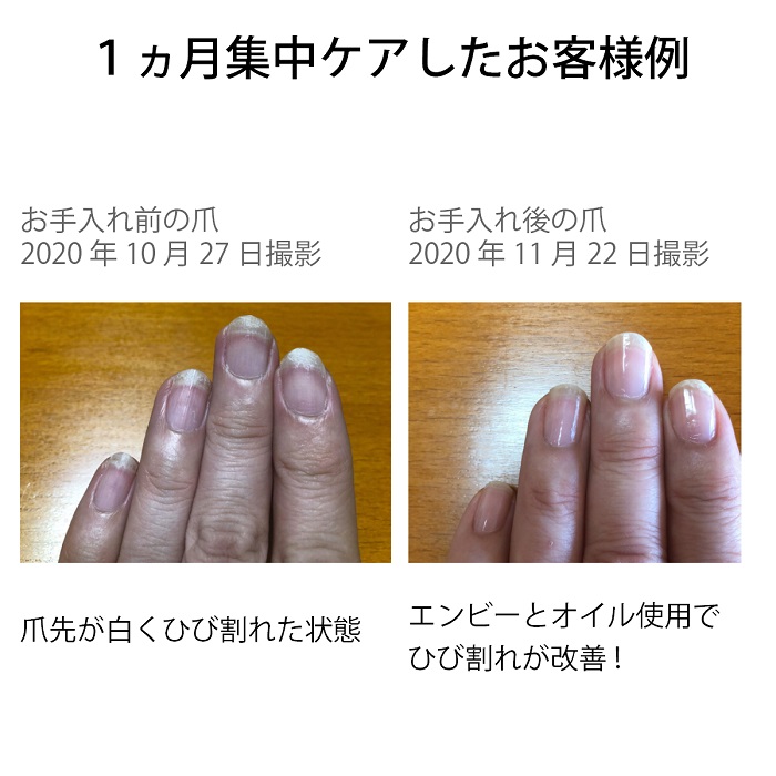 爪割れ防止ケアセット Opi最強コンビ Opi Opi オーピーアイ ネイルエンビー プロスパ キューティクルオイル 爪割れ 割れる 薄爪 二枚爪 ネイルケア 乾燥 ささくれ マニュアル付