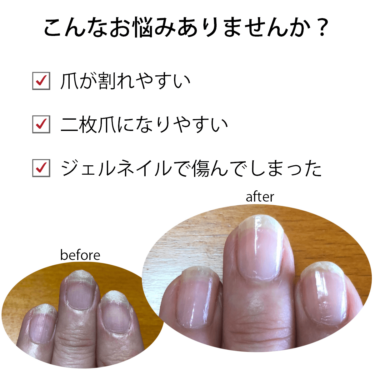 宅配送料無料 爪割れ防止 お得なトライアルセット オイル14 8mlver Opi オーピーアイ ネイルエンビー キューティクルオイル 大人ネイル アセトンフリー リムーバー 爪割れ 割れる 薄爪 二枚爪 ネイルケア 乾燥 ささくれ オイル マニュアル付